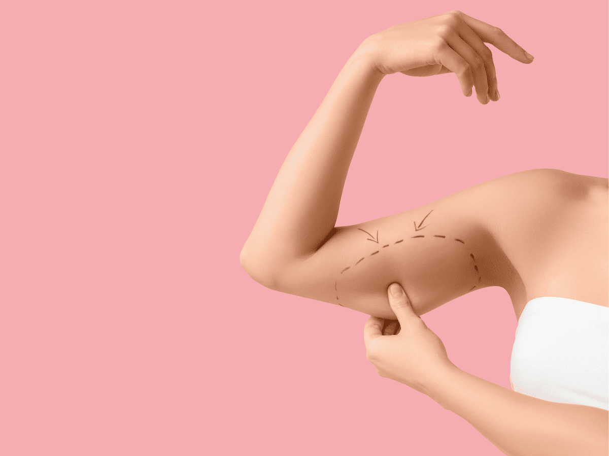 You are currently viewing The Arm Lift That Balances Elegance and Function