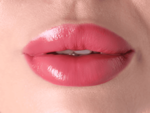 Read more about the article Thinking About a Lip Lift? Here’s What Actually Changes
